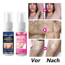 Laden Sie das Bild in den Galerie-Viewer, 🎉Sommer-Specials🎉Kraftvolles und schmerzfreies Haarentfernungsspray