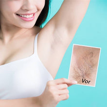 Laden Sie das Bild in den Galerie-Viewer, 🎉Sommer-Specials🎉Kraftvolles und schmerzfreies Haarentfernungsspray